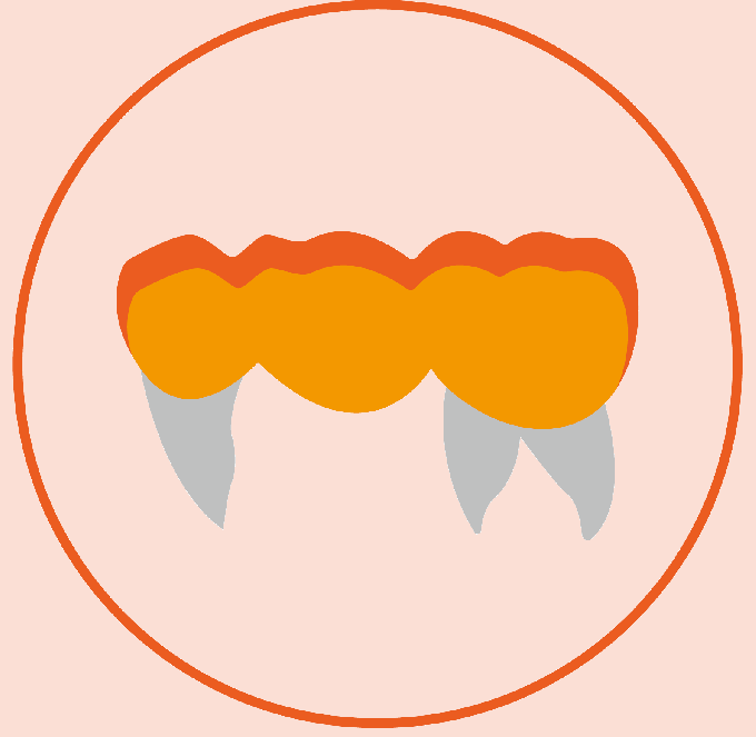 Reduced Posterior Bridge   (3 units)